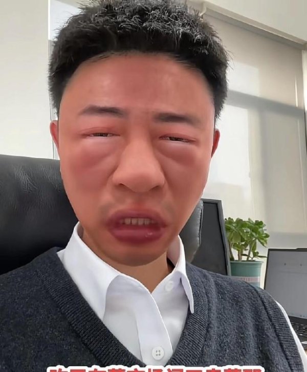 男子误把漆树芽当香椿 吃完脸浮肿 警惕“毒兄弟”误食风险